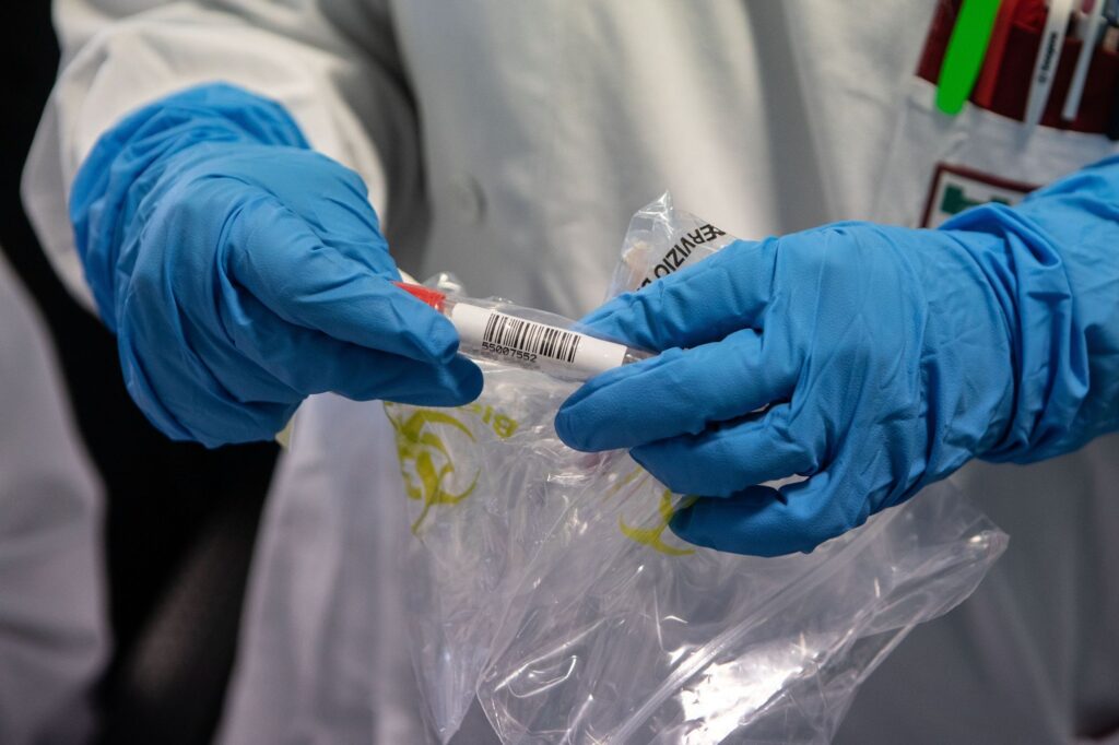 Coronavirus Sicilia oggi casi provincia Catania Adrano Biancavilla Covid
