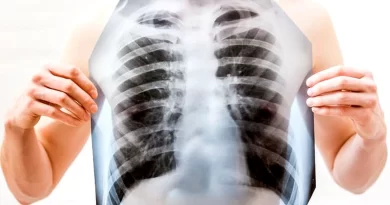 screening polmonare ospedale cannizzaro catania